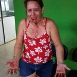 Marido é preso suspeito de morder e arrancar parte do lábios da sua companheira PLANTÃO POLICIAL