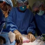 Pela primeira vez, rim suíno é transplantado com sucesso em humano TEMA LIVRE