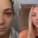 Adolescente fica com ‘olhos de zumbi’ após extensão de cílios TEMA LIVRE