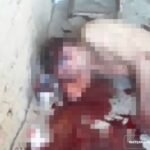 Homem é brutalmente ferido em uma tentativa de homicídio na zona rural de Quixeramobim QUIXERAMOBIM