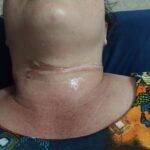 Mulher em Quixeramobim escapa por pouco de acidente gravíssimo com fio de internet solto” QUIXERAMOBIM