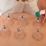 Inscrições Abertas para o Curso Gratuito de Ventosaterapia em Quixeramobim QUIXERAMOBIM